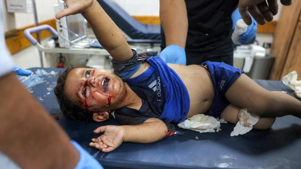 The world must stop Israel's unprecedented assault on Palestinian children